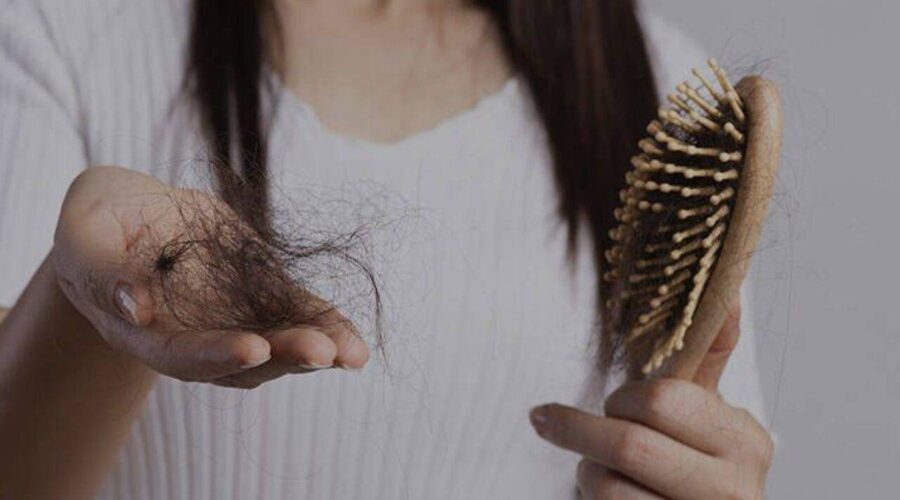 caída de cabello post parto