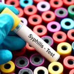 tubo de sangre para prueba de sífilis
