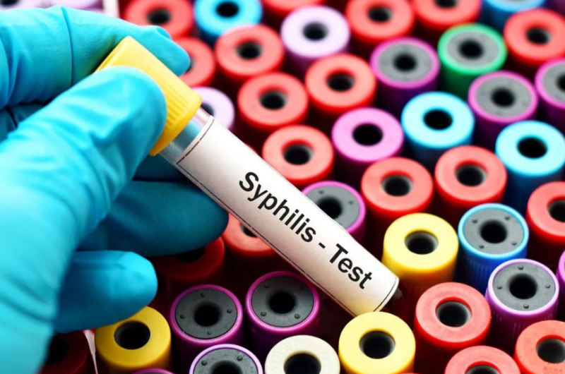 tubo de sangre para prueba de sífilis