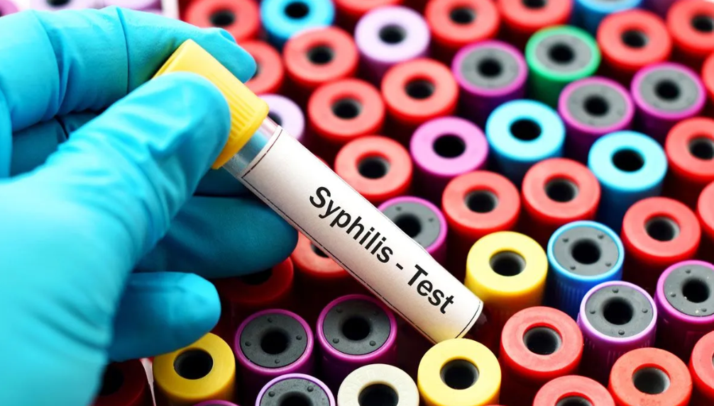 tubo de sangre para prueba de sífilis